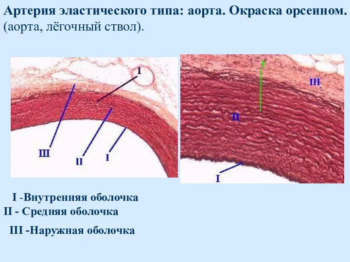 Артерия эластического типа: аорта. Окраска орсеином. (аорта, лёгочный ствол). I -Внутренняя оболочка II