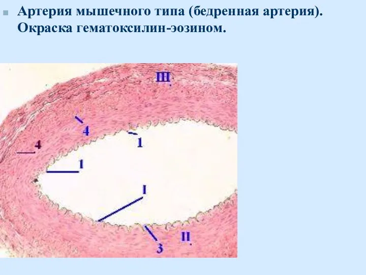 Артерия мышечного типа (бедренная артерия). Окраска гематоксилин-эозином.