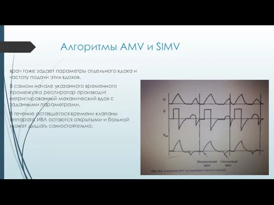 Алгоритмы AMV и SIMV врач тоже задает параметры отдельного вдоха и частоту подачи