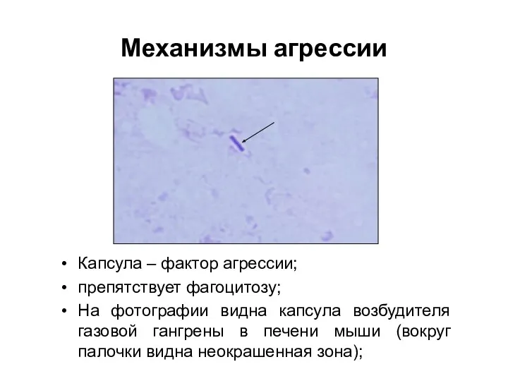 Капсула – фактор агрессии; препятствует фагоцитозу; На фотографии видна капсула