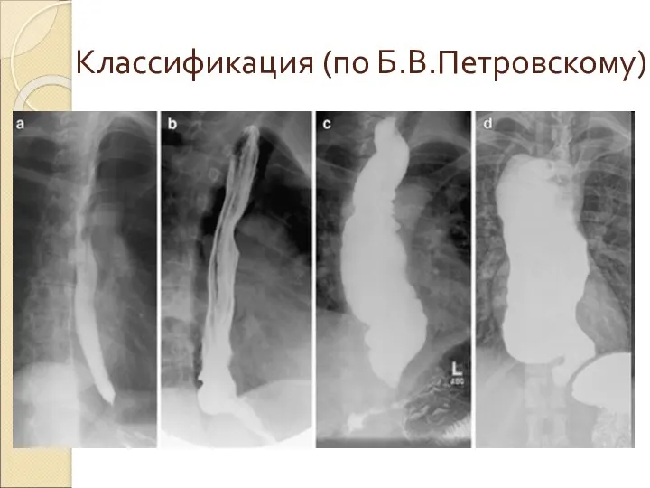 Классификация (по Б.В.Петровскому)