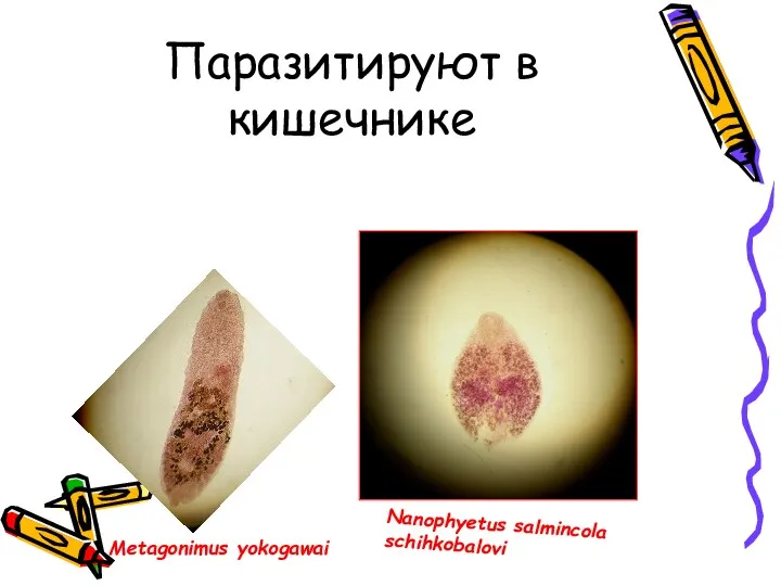 Паразитируют в кишечнике Nanophyetus salmincola schihkobalovi Metagonimus yokogawai
