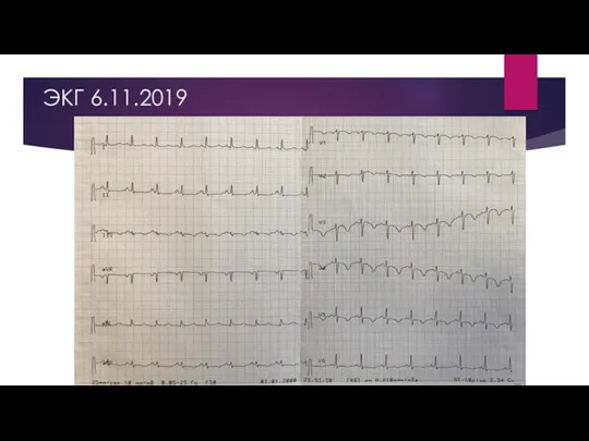 ЭКГ 6.11.2019