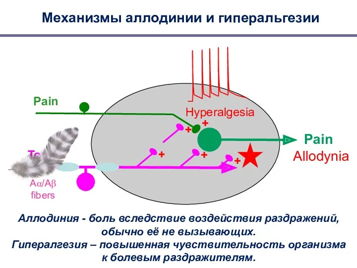 Pain Аллодиния - боль вследствие воздействия раздражений, обычно её не вызывающих. Гипералгезия –