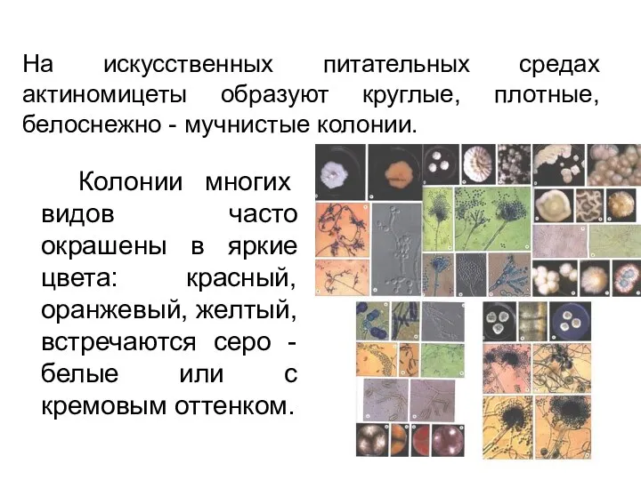 На искусственных питательных средах актиномицеты образуют круглые, плотные, белоснежно -