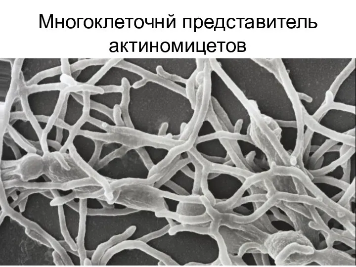 Многоклеточнй представитель актиномицетов