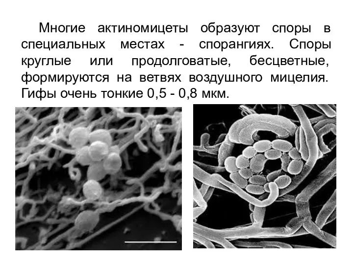 Многие актиномицеты образуют споры в специальных местах - спорангиях. Споры