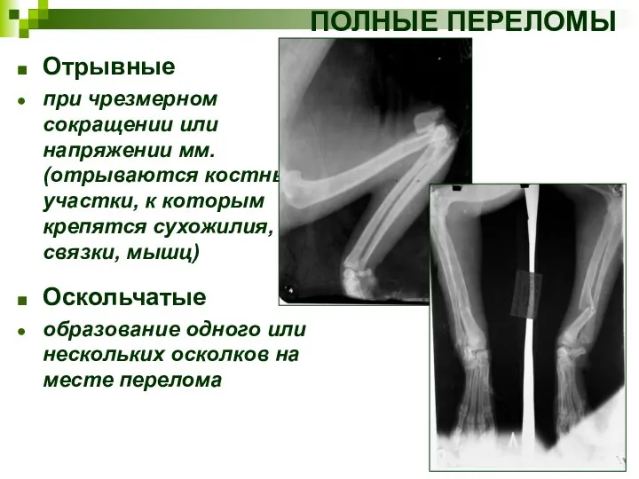 Отрывные при чрезмерном сокращении или напряжении мм. (отрываются костные участки, к которым крепятся