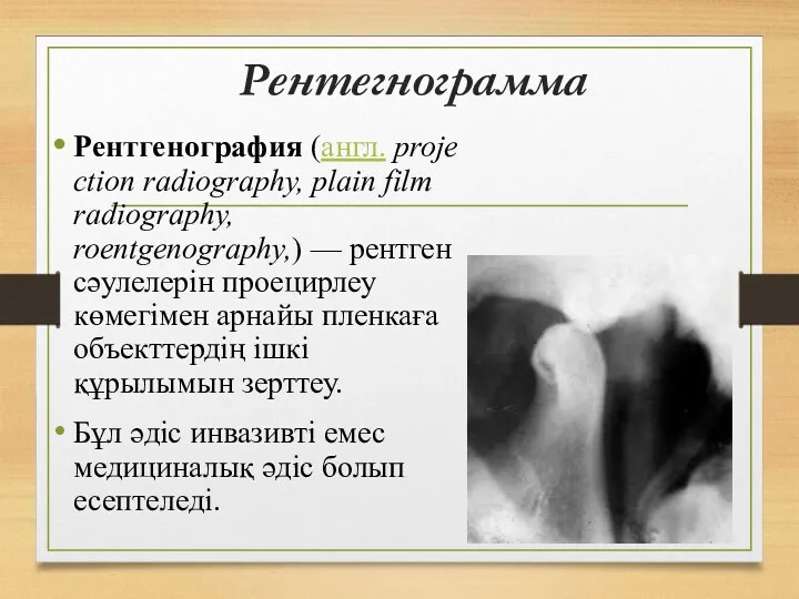 Рентегнограмма Рентгенография (англ. projection radiography, plain film radiography, roentgenography,) —
