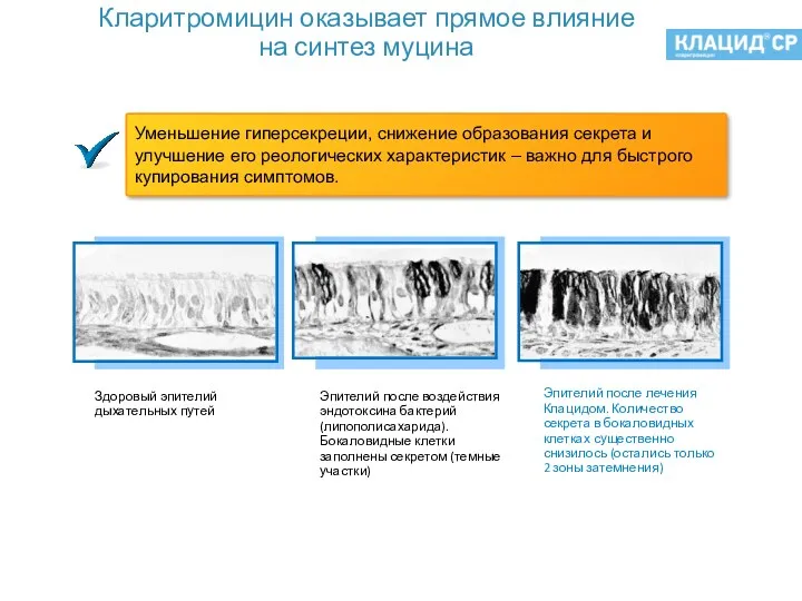 Кларитромицин оказывает прямое влияние на синтез муцина Takeshi Shimizu et al, American Journal