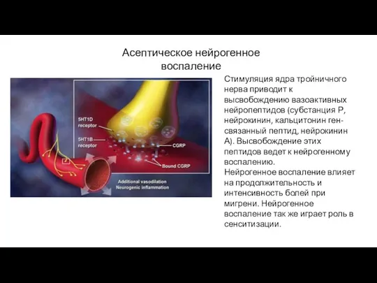 Стимуляция ядра тройничного нерва приводит к высвобождению вазоактивных нейропептидов (субстанция