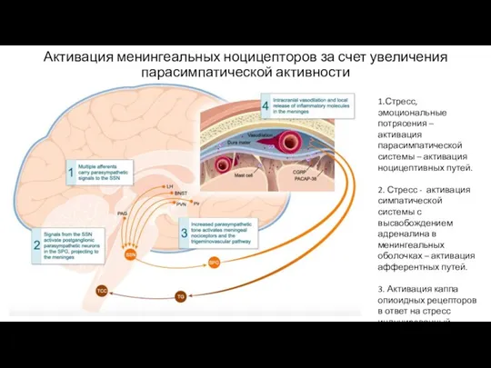 Активация менингеальных ноцицепторов за счет увеличения парасимпатической активности 1.Стресс, эмоциональные