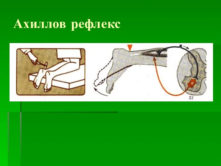 Ахиллов рефлекс