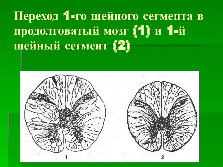 Переход 1-го шейного сегмента в продолговатый мозг (1) и 1-й шейный сегмент (2)