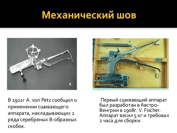 Механический шов Первый сшивающий аппарат был разработан в Австро-Венгрии в
