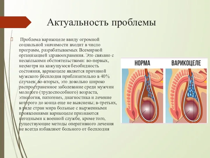 Проблема варикоцеле ввиду огромной социальной значимости входит в число программ,