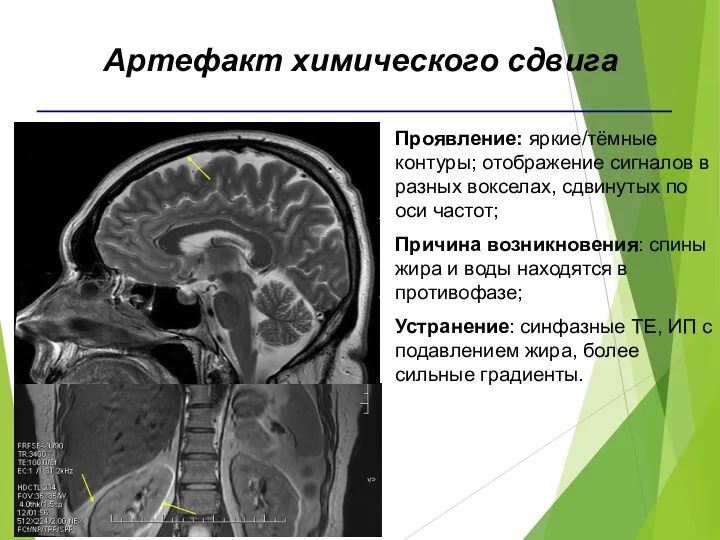 Проявление: яркие/тёмные контуры; отображение сигналов в разных вокселах, сдвинутых по