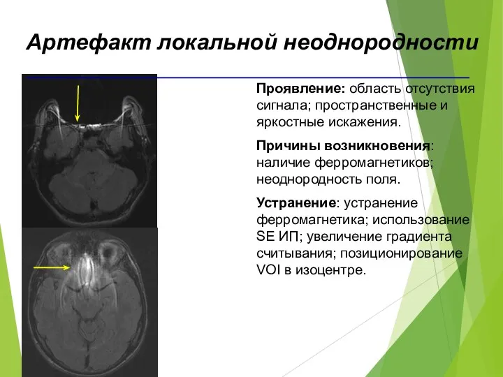 Проявление: область отсутствия сигнала; пространственные и яркостные искажения. Причины возникновения: