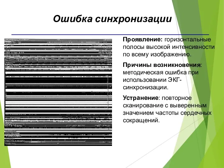 Проявление: горизонтальные полосы высокой интенсивности по всему изображению. Причины возникновения: