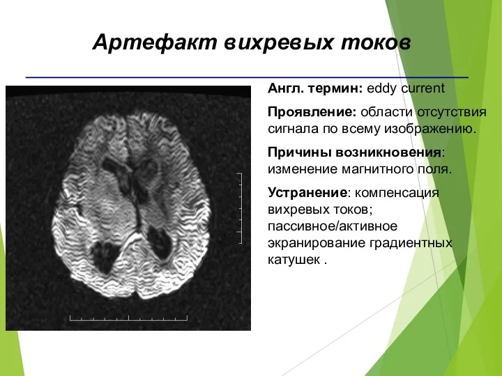 Англ. термин: eddy current Проявление: области отсутствия сигнала по всему