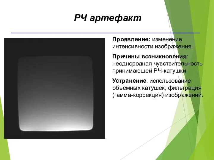 Проявление: изменение интенсивности изображения. Причины возникновения: неоднородная чувствительность принимающей РЧ-катушки.