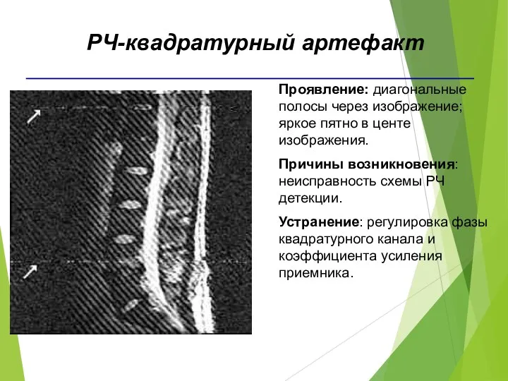 Проявление: диагональные полосы через изображение; яркое пятно в центе изображения.