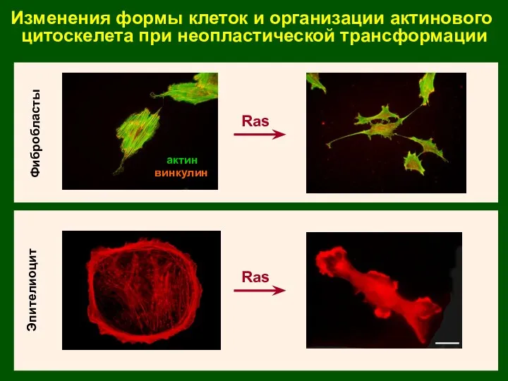 Изменения формы клеток и организации актинового цитоскелета при неопластической трансформации Эпителиоцит Фибробласты Ras