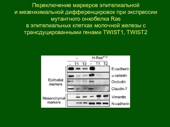 Переключение маркеров эпителиальной и мезенхимальной дифференцировок при экспрессии мутантного онкобелка