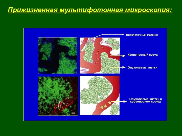 Прижизненная мультифотонная микроскопия: Опухолевые клетки в кровеносном сосуде Кровеносный сосуд Опухолевые клетки Внеклеточный матрикс