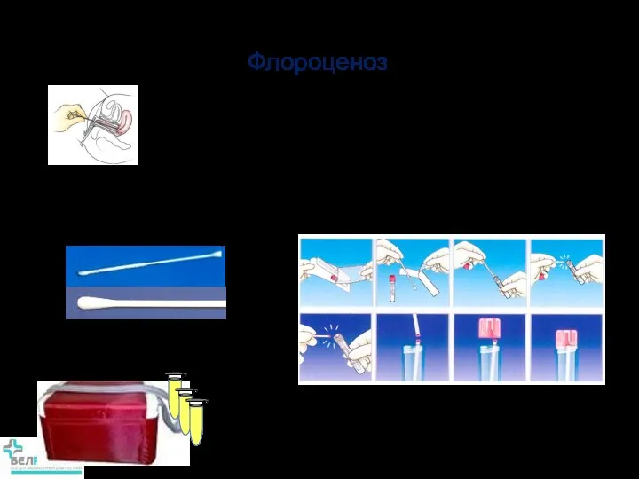 Особенности получения биоматериала для теста Флороценоз Материал для исследования, включая