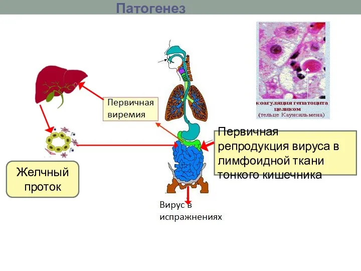 Патогенез Патогенез Первичная репродукция вируса в лимфоидной ткани тонкого кишечника Желчный проток
