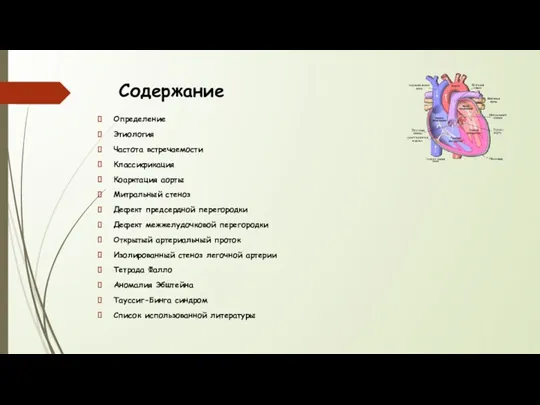 Содержание Определение Этиология Частота встречаемости Классификация Коарктация аорты Митральный стеноз