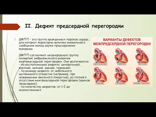 II. Дефект предсердной перегородки ДМПП - это группа врожденных пороков