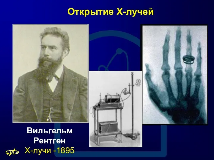 Вильгельм Рентген Х-лучи -1895 Открытие X-лучей