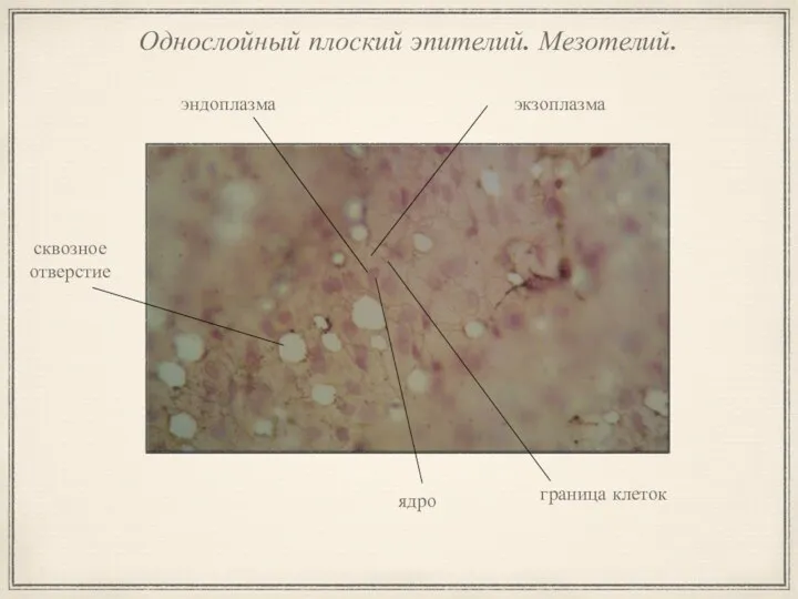 Однослойный плоский эпителий. Мезотелий. экзоплазма сквозное отверстие эндоплазма граница клеток ядро