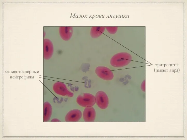 Мазок крови лягушки сегментоядерные нейтрофилы эритроциты (имеют ядра)