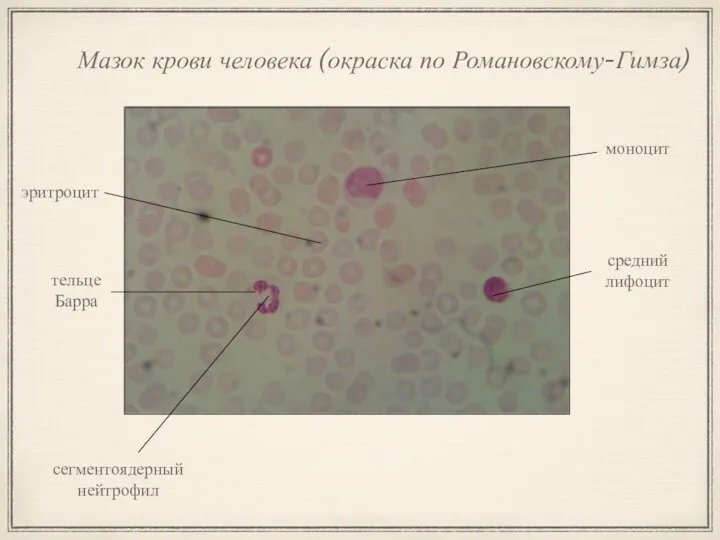 Мазок крови человека (окраска по Романовскому-Гимза) эритроцит сегментоядерный нейтрофил моноцит средний лифоцит тельце Барра
