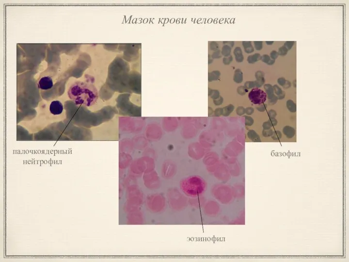 Мазок крови человека эозинофил хорда энтеробласт базофил палочкоядерный нейтрофил