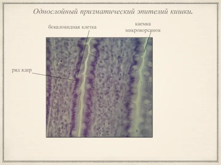 Однослойный призматический эпителий кишки. ряд ядер каемка микроворсинок бокаловидная клетка