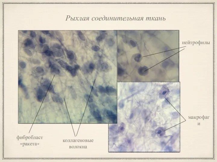 Рыхлая соединительная ткань фибробласт «ракета» нейтрофилы коллагеновые волокна макрофаги