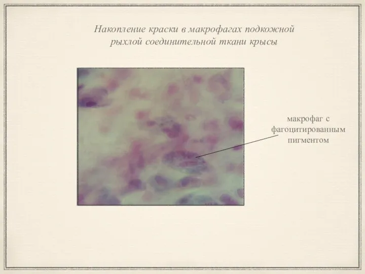 Накопление краски в макрофагах подкожной рыхлой соединительной ткани крысы макрофаг с фагоцитированным пигментом