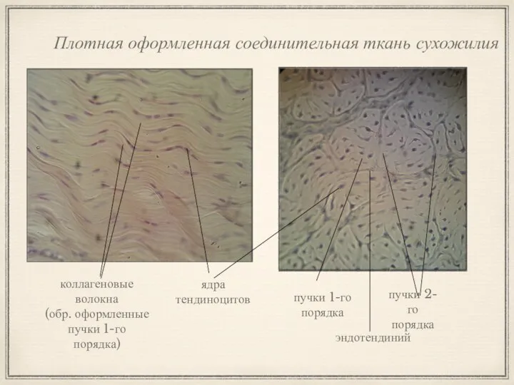 Плотная оформленная соединительная ткань сухожилия ядра тендиноцитов коллагеновые волокна (обр.