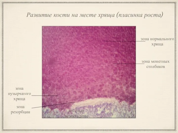 Развитие кости на месте хряща (пласинка роста) зона нормального хряща