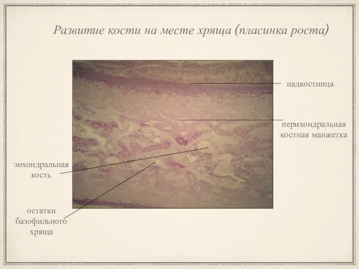 Развитие кости на месте хряща (пласинка роста) надкостница перихондральная костная манжетка энхондральная кость остатки базофильного хряща