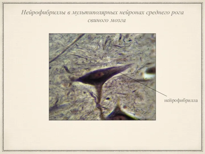 Нейрофибриллы в мультиполярных нейронах среднего рога свиного мозга нейрофибрилла