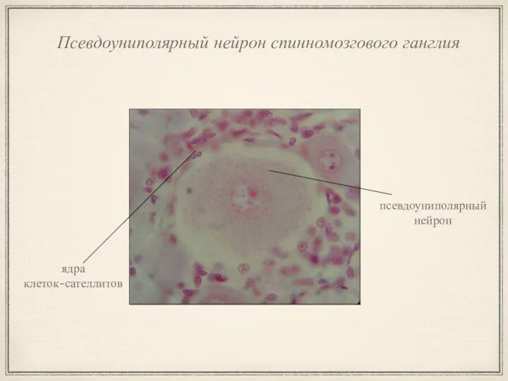 Псевдоуниполярный нейрон спинномозгового ганглия псевдоуниполярный нейрон ядра клеток-сателлитов
