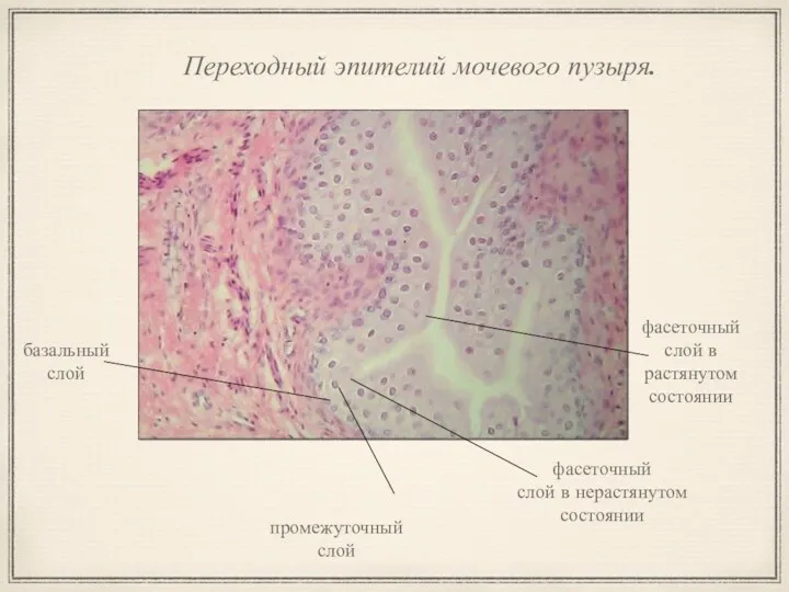 Переходный эпителий мочевого пузыря. фасеточный слой в нерастянутом состоянии промежуточный