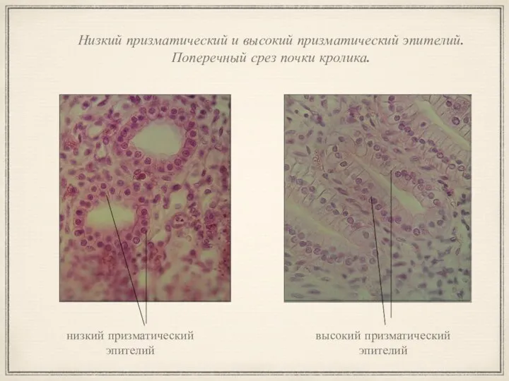 Низкий призматический и высокий призматический эпителий. Поперечный срез почки кролика. высокий призматический эпителий низкий призматический эпителий