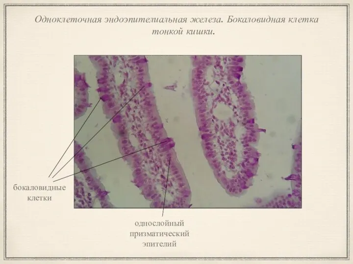 Одноклеточная эндоэпителиальная железа. Бокаловидная клетка тонкой кишки. бокаловидные клетки однослойный призматический эпителий