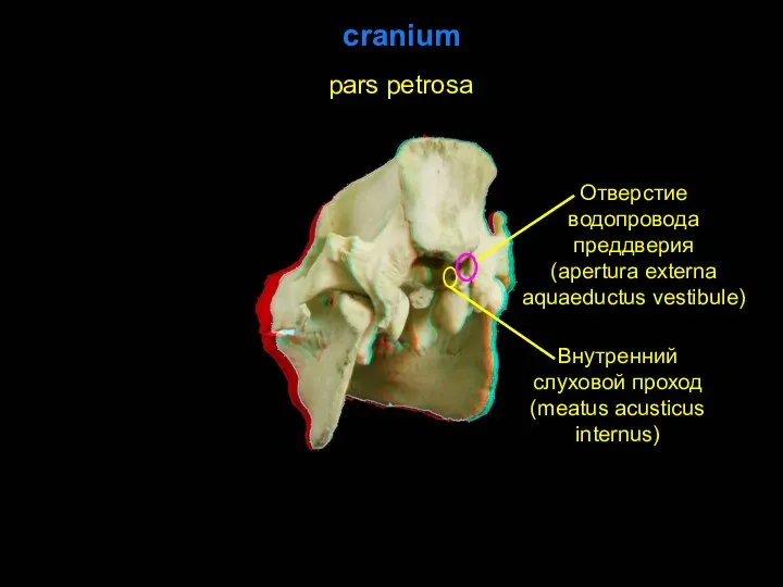 cranium pars petrosa Отверстие водопровода преддверия (apertura externa aquaeductus vestibule) Внутренний слуховой проход (meatus acusticus internus)